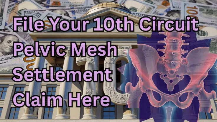 File Your 10th Circuit Pelvic Mesh Settlement Claim Here text on depiction of Tenth Circuit court with pelvis xray and high-value cash backdrop.