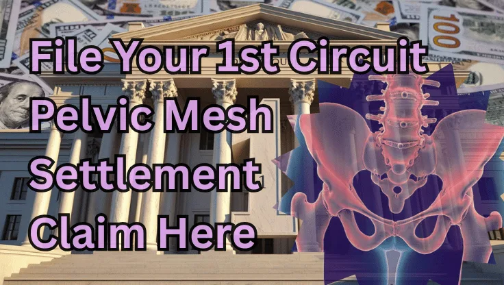 File Your 1st Circuit Pelvic Mesh Settlement Claim Here text on depiction of First Circuit court with pelvis xray and high-value cash backdrop.
