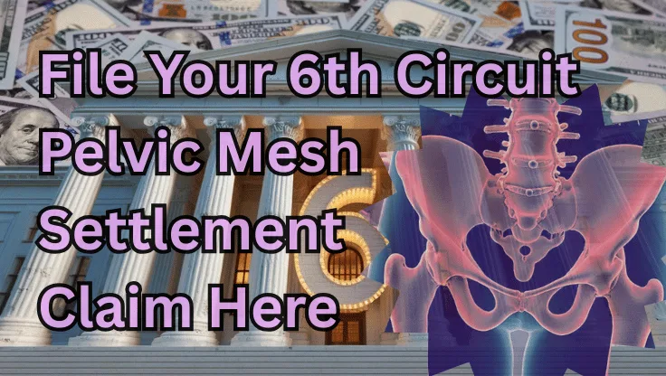 File Your 6th Circuit Pelvic Mesh Settlement Claim Here text on depiction of Sixth Circuit court with pelvis xray and high-value cash backdrop.