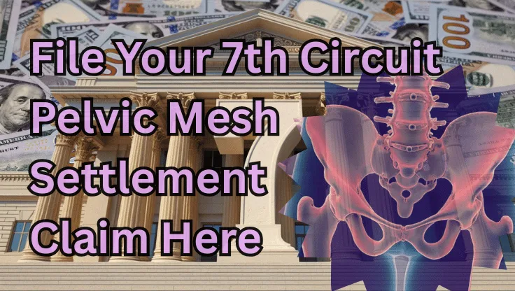 File Your 7th Circuit Pelvic Mesh Settlement Claim Here text on depiction of Seventh Circuit court with pelvis xray and high-value cash backdrop.