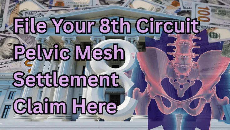 File Your 8th Circuit Pelvic Mesh Settlement Claim Here text on depiction of Eighth Circuit court with pelvis xray and high-value cash backdrop.