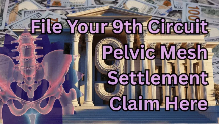 File Your 9th Circuit Pelvic Mesh Settlement Claim Here text on depiction of Ninth Circuit court with pelvis xray and high-value cash backdrop.
