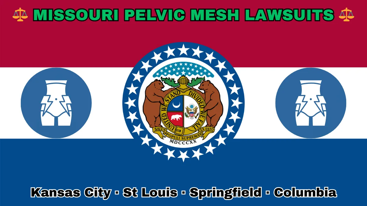 MISSOURI PELVIC MESH LAWSUITS: Kansas City, St Louis, Springfield, and Columbia text on MO state flag adorned with transvaginal bladder mesh depicted near a ring of stars featuring two grizzly bears, a shield, and crescent moon, all on a red, white and blue background.